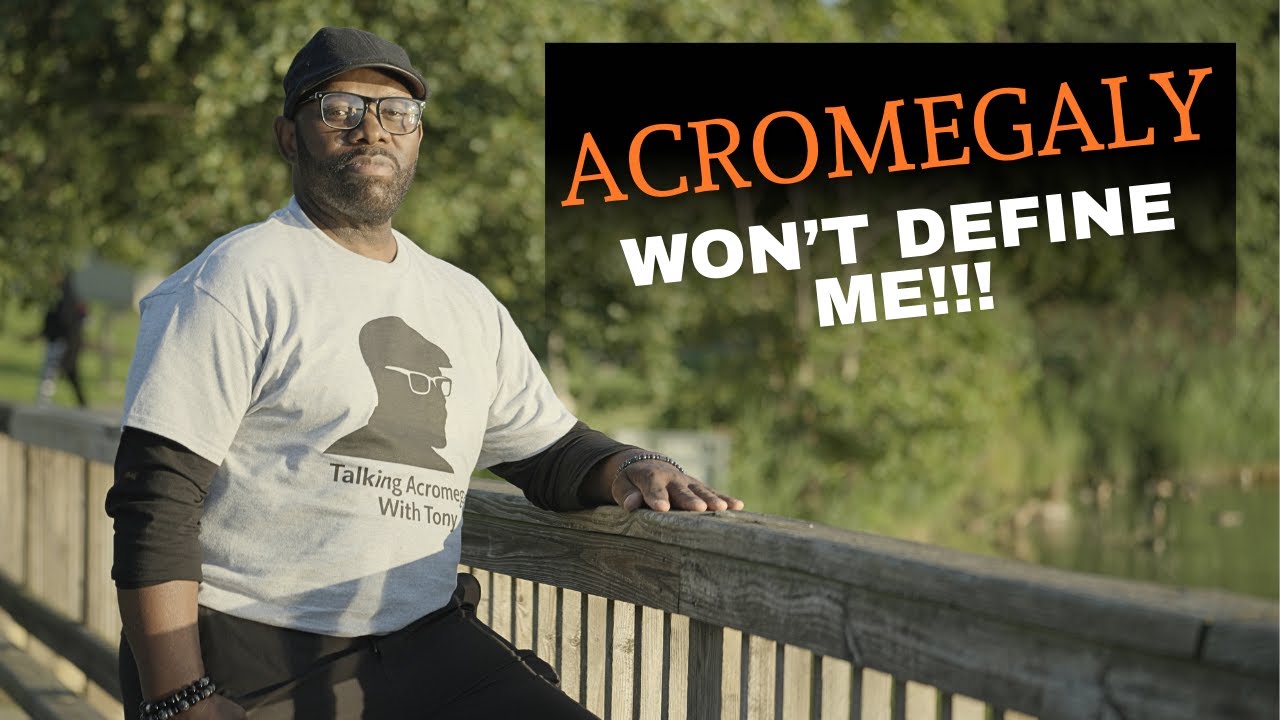 I Have Acromegaly. It Won't Define Me.