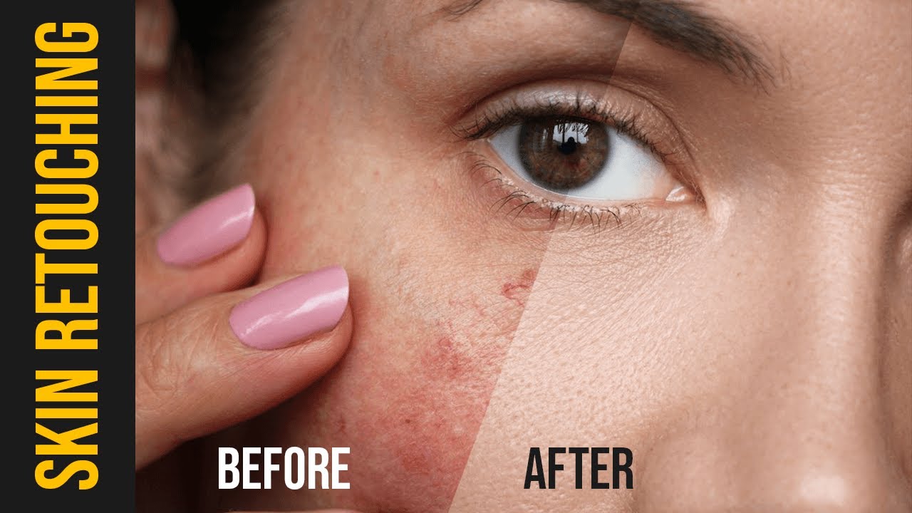 Skin retouching  dodge & burn, frequency separation in photoshop