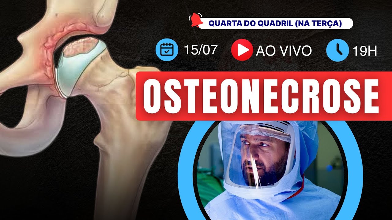 Ostenecrose! Você precisa saber! Quarta do Quadril nº172 -  Faça sua pergunta AO VIVO