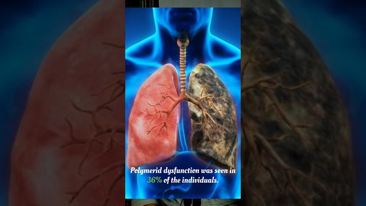 A previous pandemic is it mirror for our future #health #medinfo #lunghealth @arivu-6
