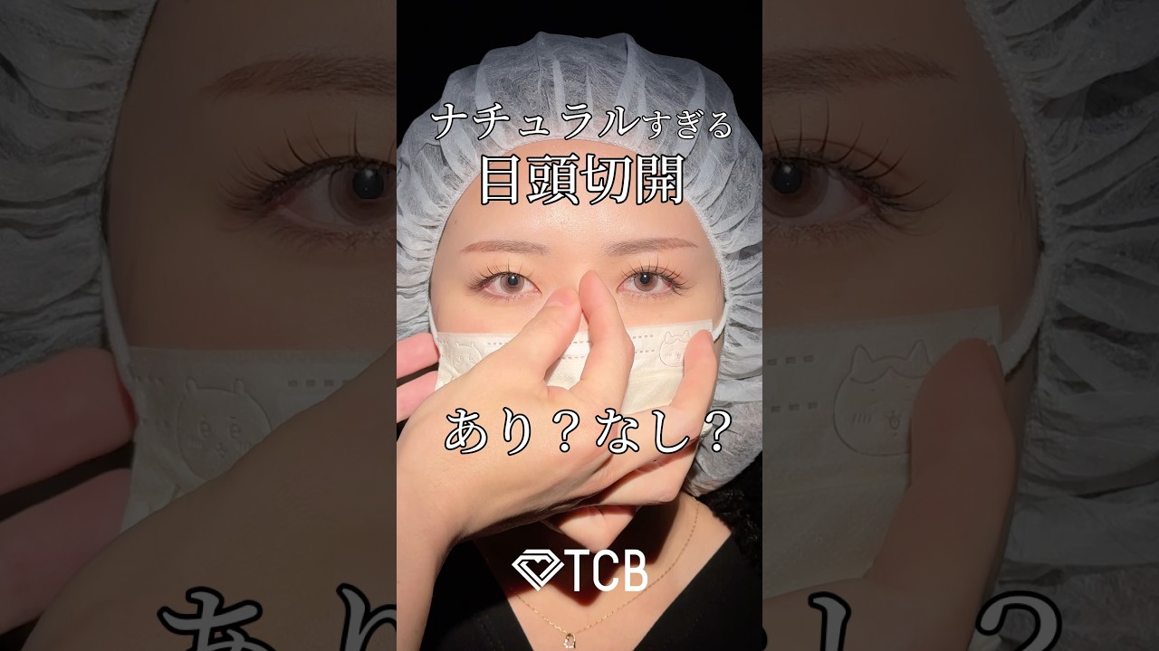 【二重整形】ナチュラルすぎる目頭切開あり？#shorts
