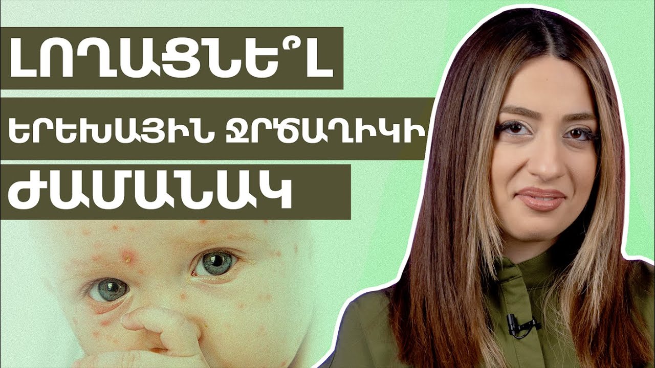 Ջրծաղիկ․ Բարդություններ և նախանշաններ | Grow Healthy 19