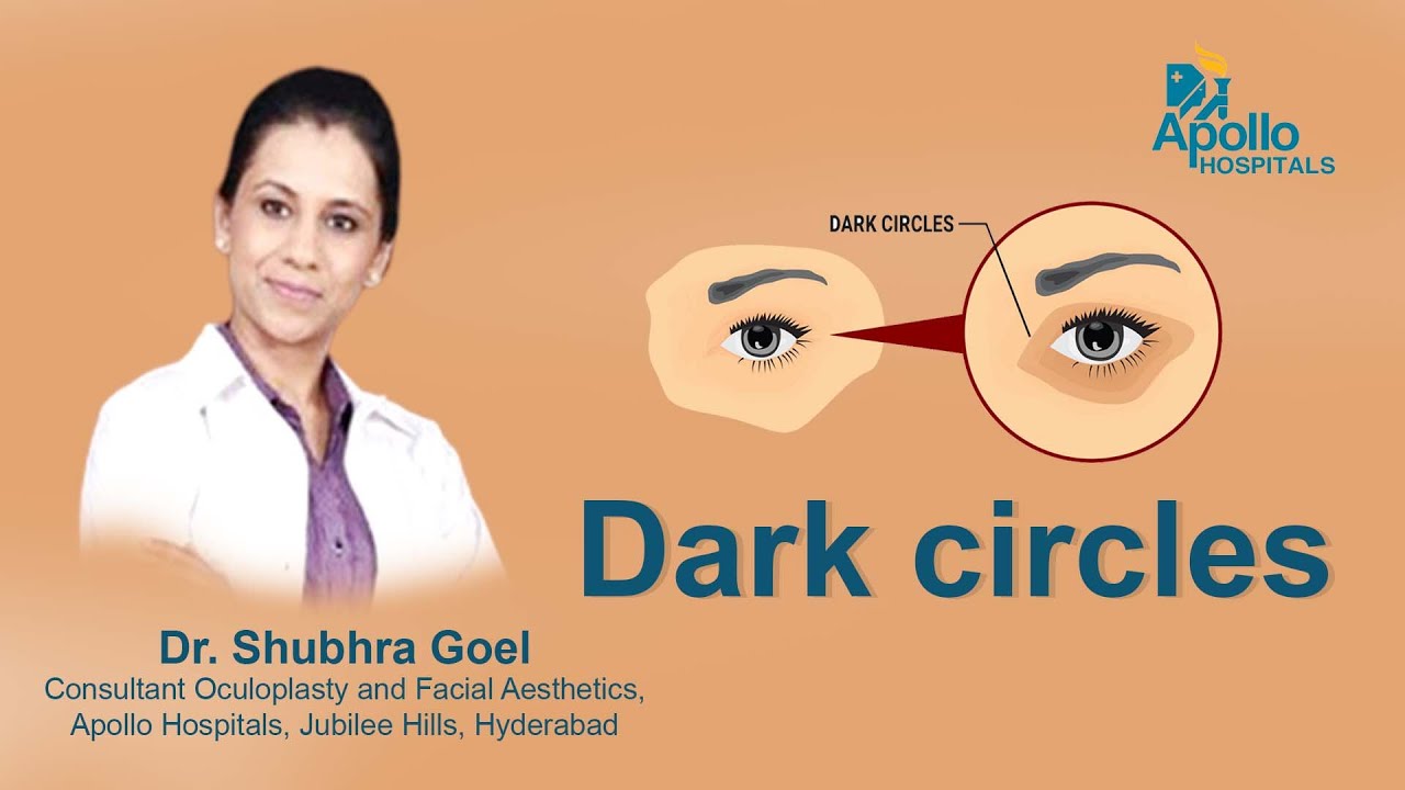 Dr. Shubhra Goel | Dark Circles | Apollo Hospital |