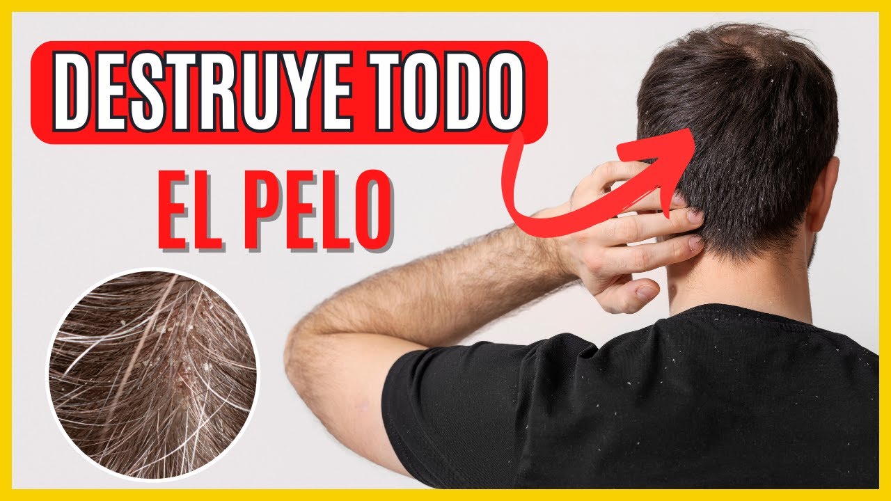 ⚠ Foliculitis CR&Oacute;NICA 👉 &iquest;Qu&eacute; es? S&Iacute;NTOMAS Y TRATAMIENTO