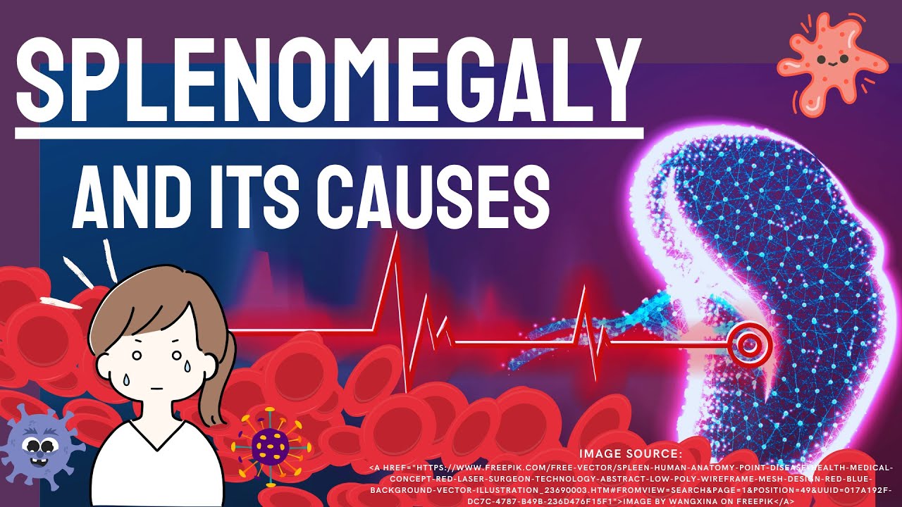 what is Splenomegaly? What Causes a spleen to enlarge?