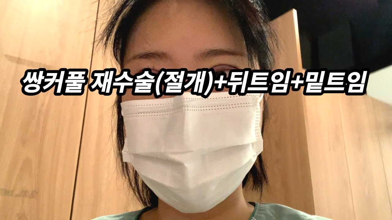 [본캐리뷰] 이세영 쌍수 또 대박 (절개 쌍커풀 재수술 첫날부터~두 달째 모습 전부 공개)