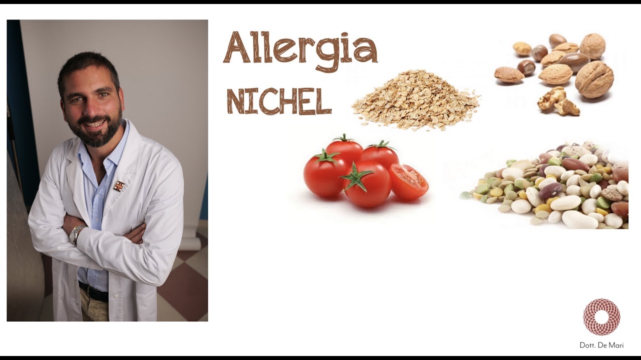 Allergia al Nichel, se quando mangi questi alimenti hai un 