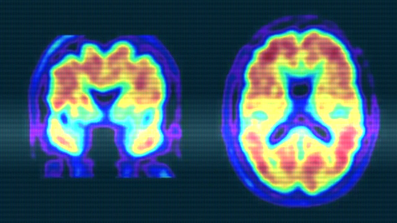 Evenue - A.I Is ?Fundamental? Risk