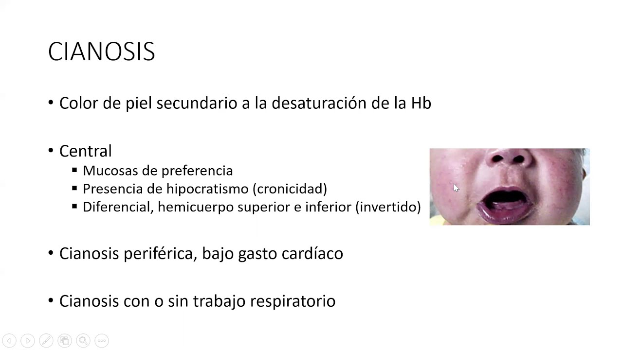 Semiología CV