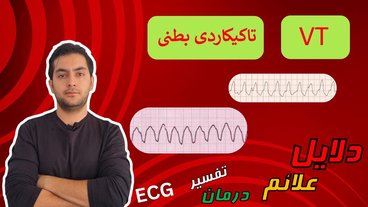 تاکیکاردی بطنی یا VT