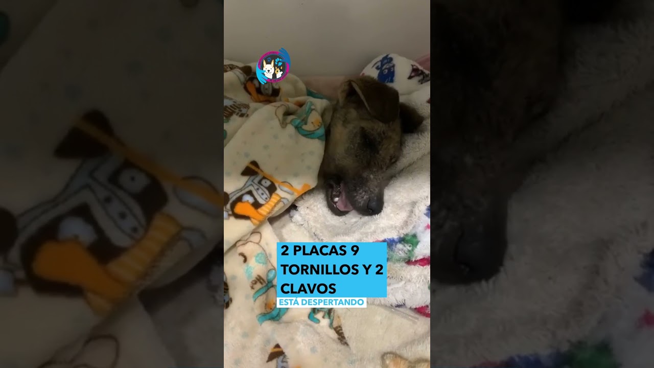 S&oacute;crates tuvo una cirug&iacute;a grande de fractura de f&eacute;mur.