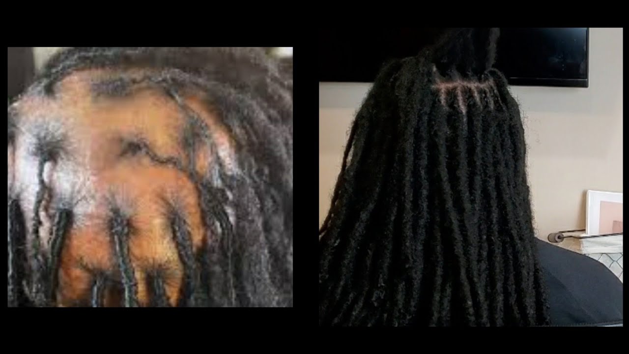 PT 1: WHY YOUR LOCS ARE FAR APART