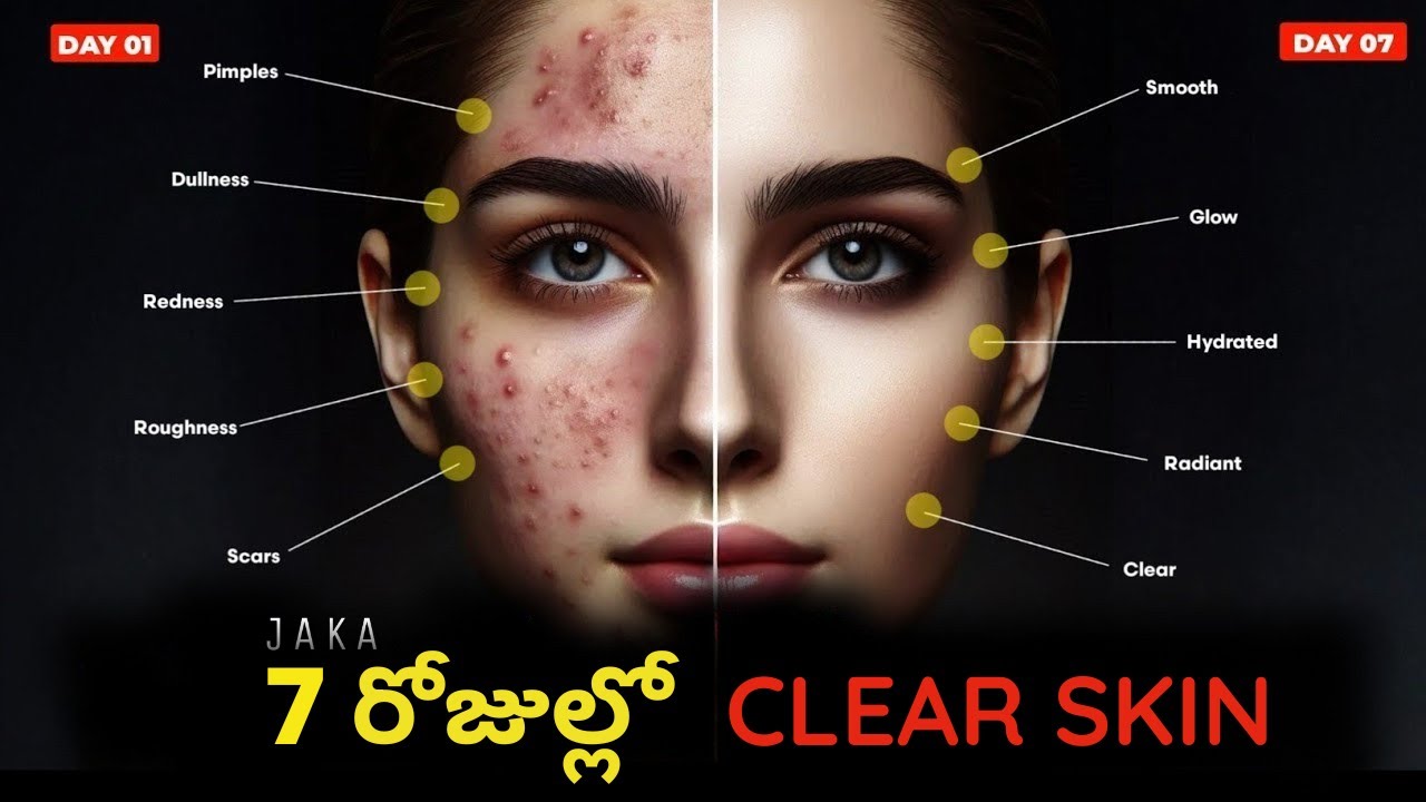 How to get a Glowing Skin in just 10 days | Perfect Skin Care routine