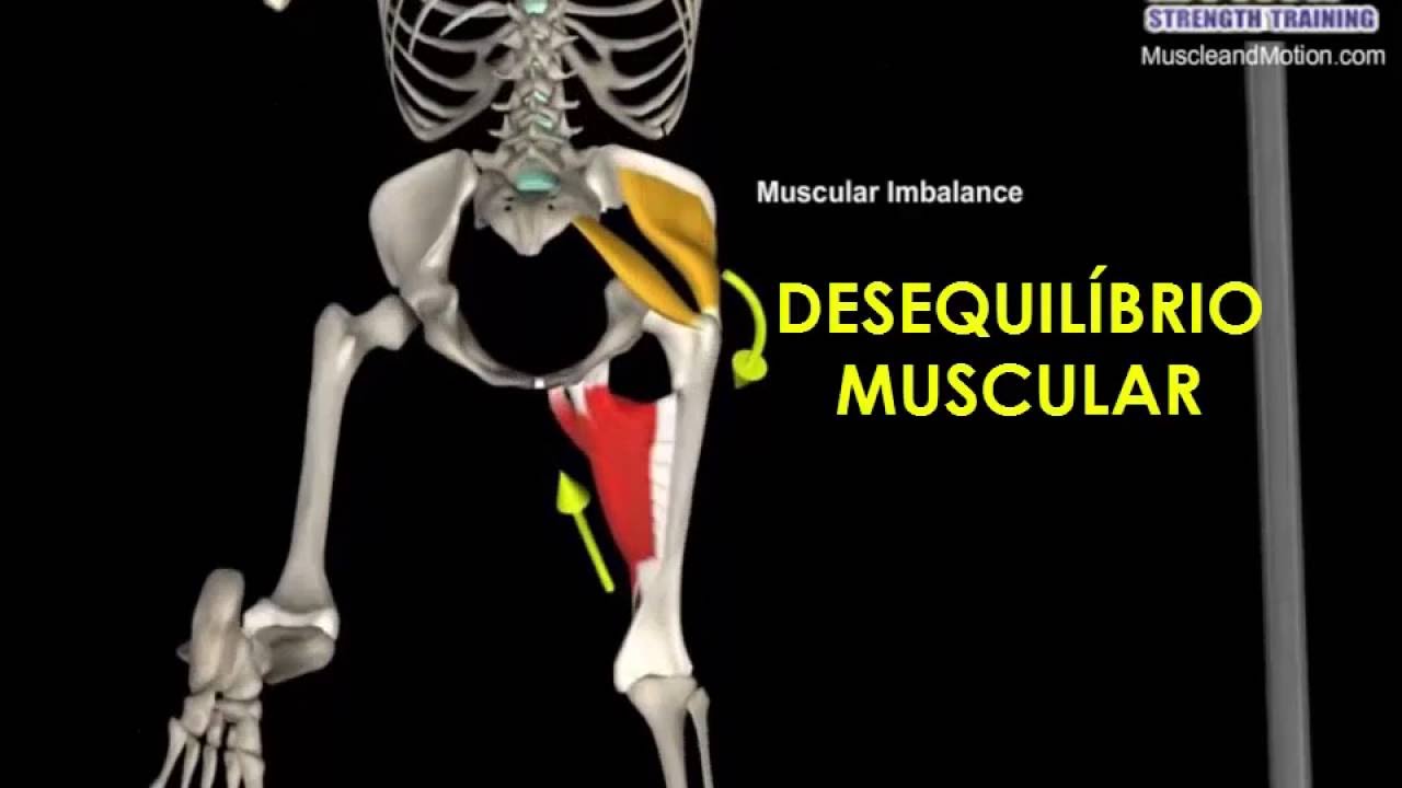 Valgo Dinamico no SQUAT: análise e recuperação