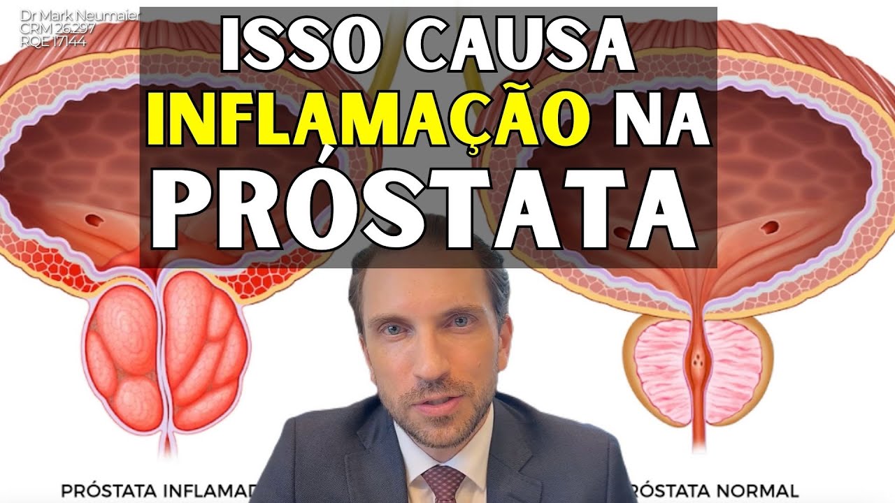 Inflamação na Próstata: O Que Pode Estar Por Trás Disso?