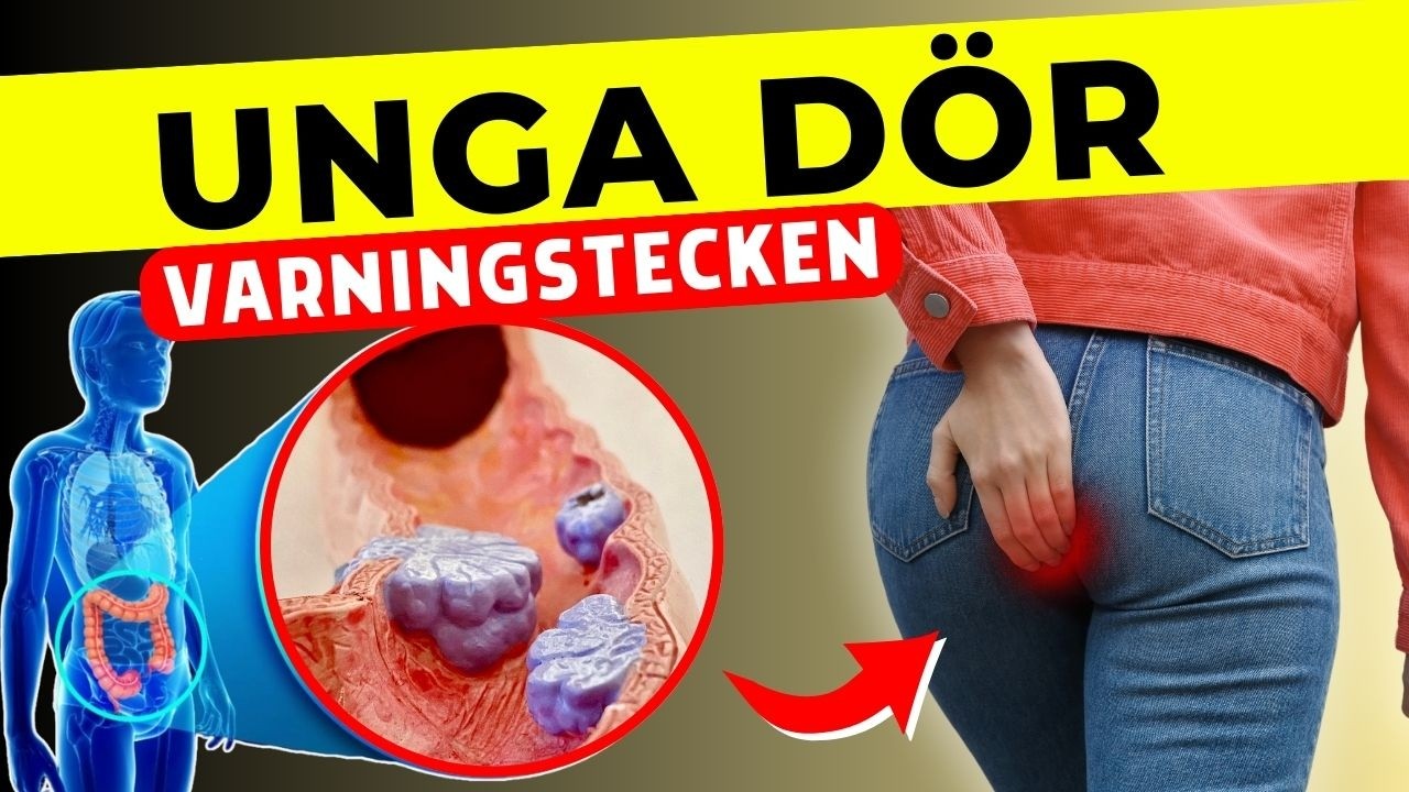 Denna cancerform drabbar allt fler unga – ignorera inte dessa varningssignaler