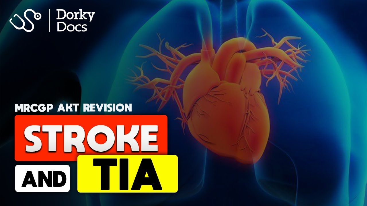 Stroke & TIA - The MRCGP AKT Exam Revision I Dorky Docs