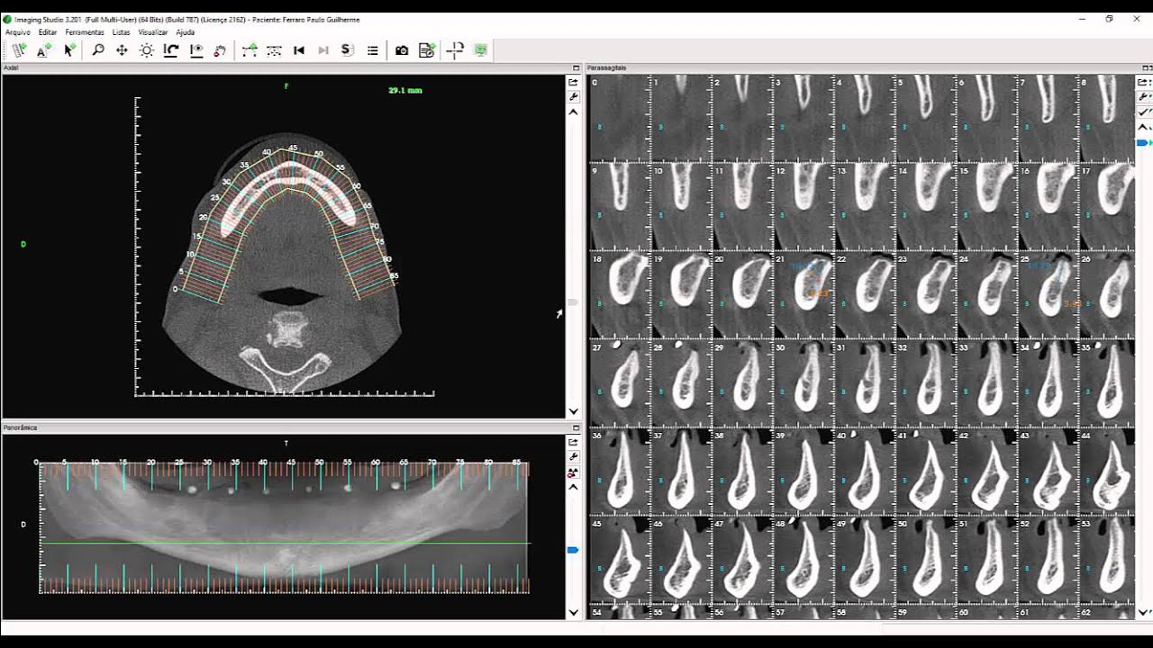 Aula 27 - Imaging Studio - Geração de Documentações