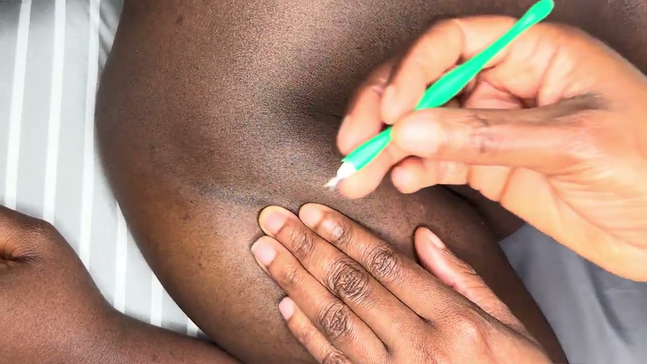 This Back Nitpicking will relax you instantly 💤 