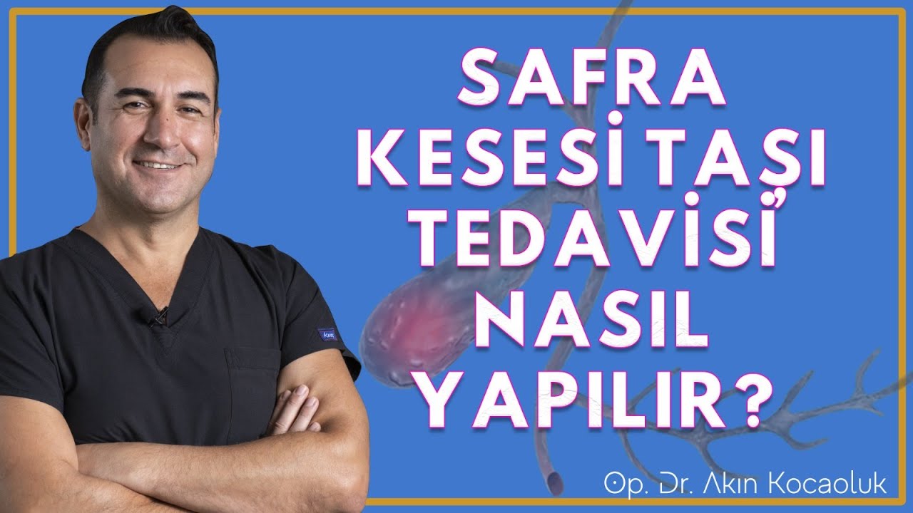 Safra Kesesi taşı nedir? Belirtileri nelerdir? Tedavisi nasıl yapılır?