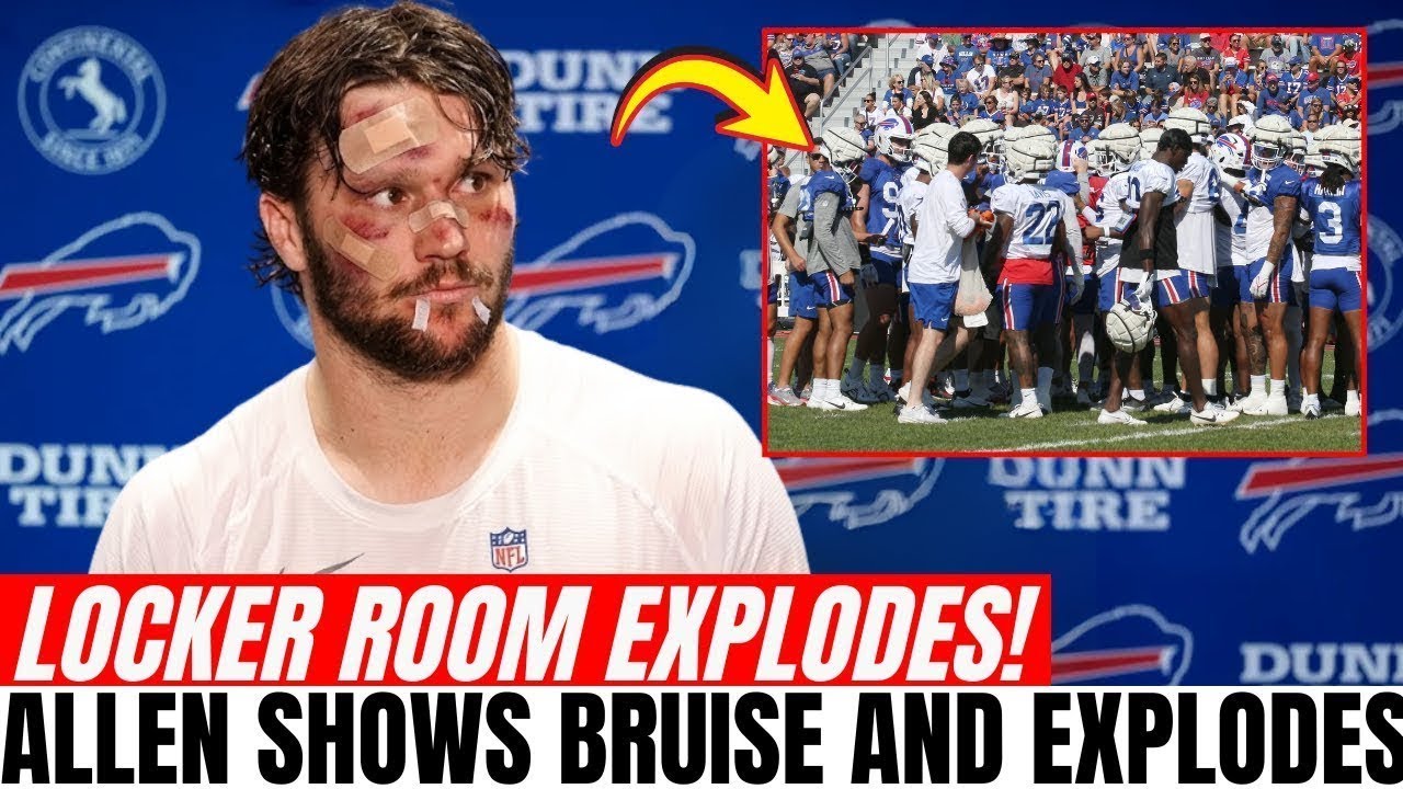 HE WAS A COWARD! Josh Allen Arrives With BRUISE ON FACE And EXPLODES! | Buffalo Bills News Today