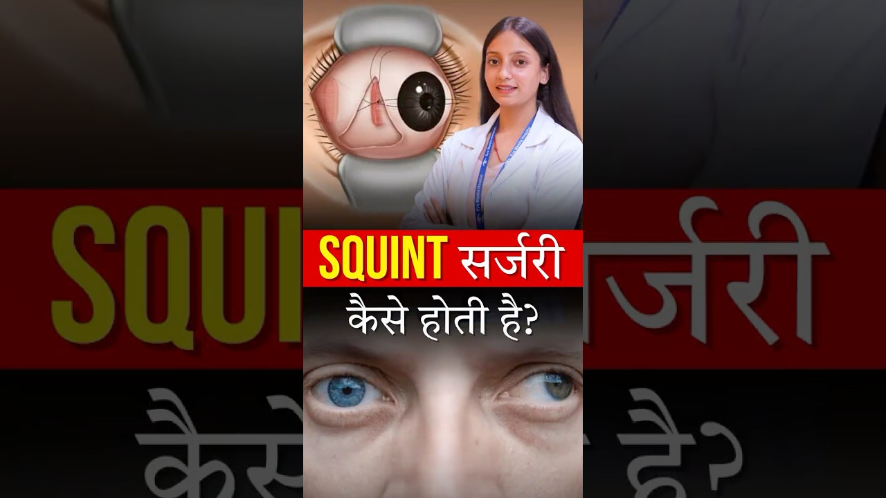 Squint (भेंगेपन) KI Surgery Kaise Ki Jati Hai?