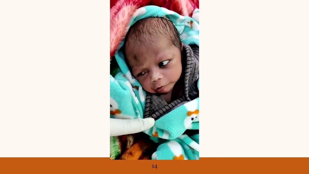 Neonatal Seizures