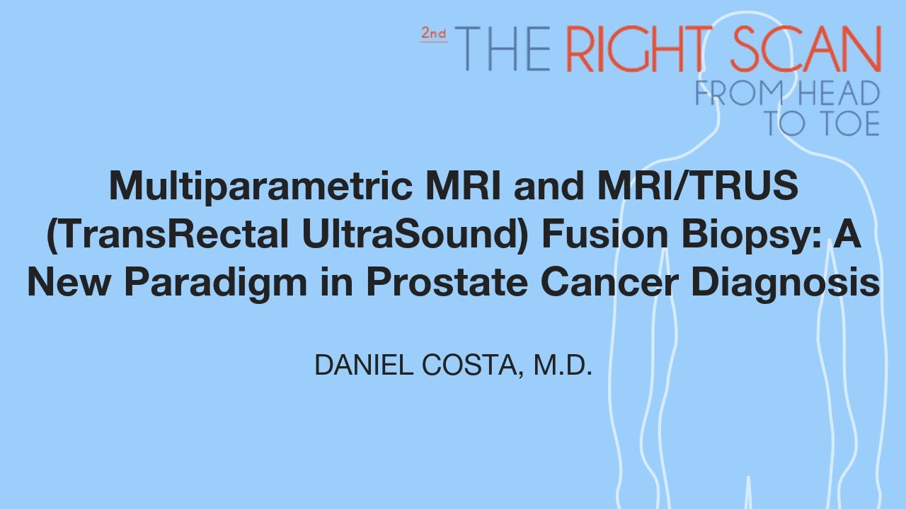 Multiparametric MRI and MRI/TRUS (TransRectal UltraSound) Fusion Biopsy