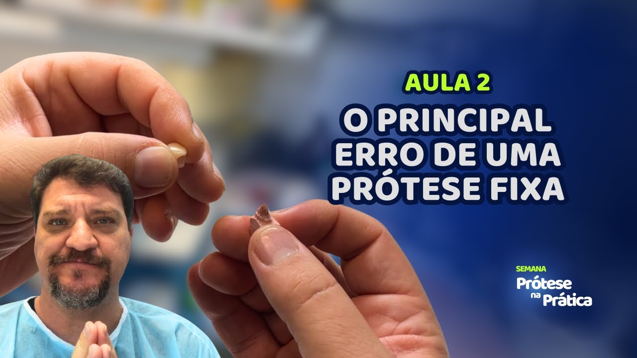 Aula 2: O principal Erro de uma Prótese Fixa | Semana da Prótese na Prática