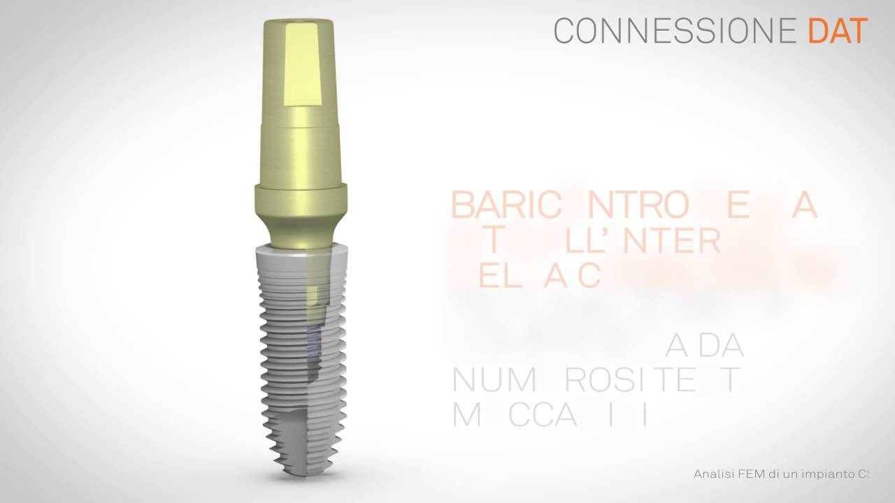 CSR-DAT:connessione conica brevettata