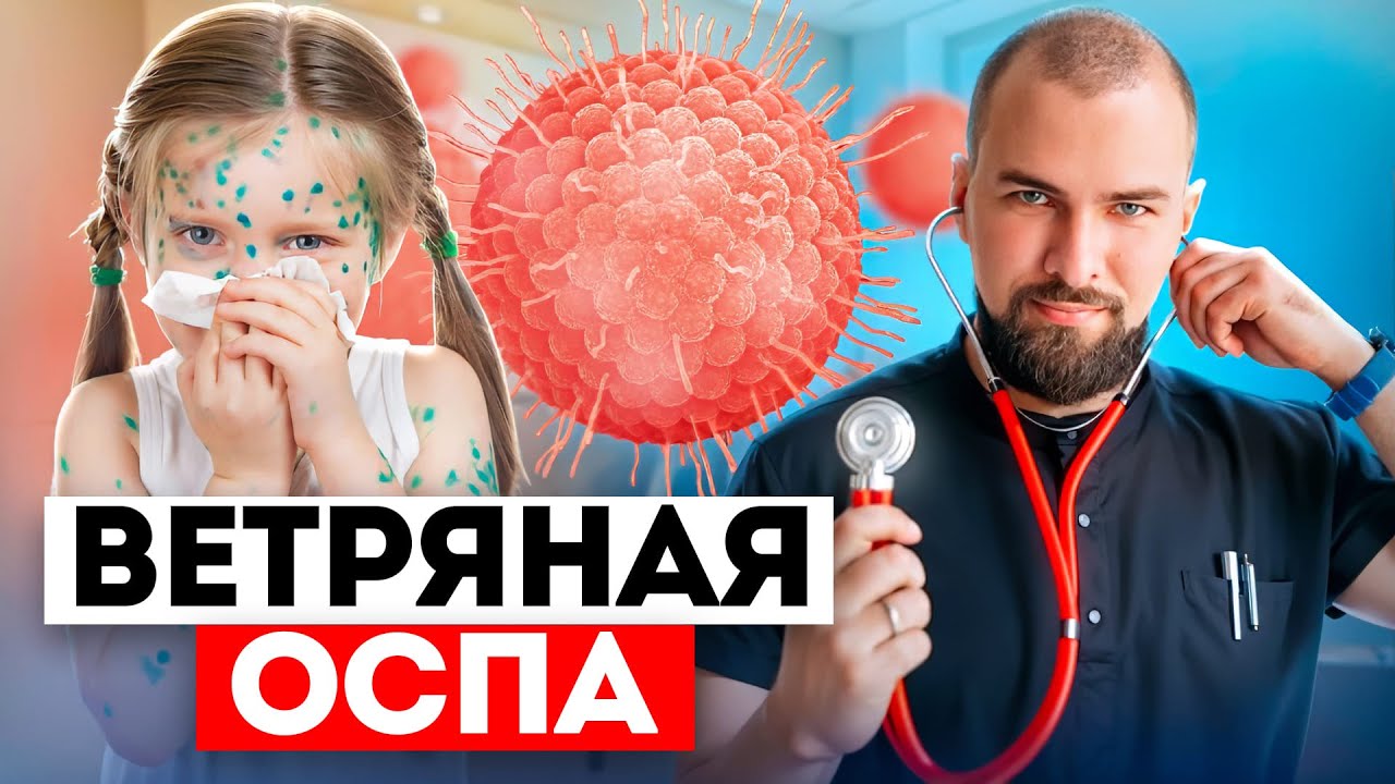 Чем опасна ветряная оспа?