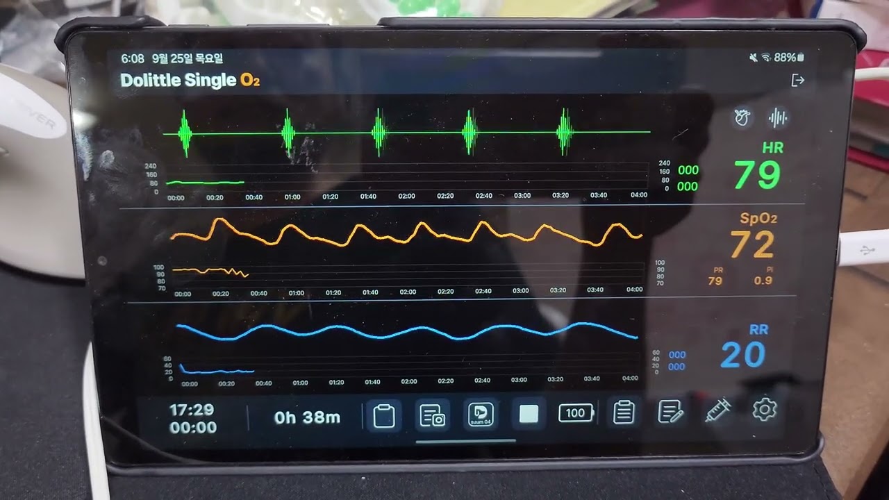 Dolittle Single O2, PPG, When SpO2 is abnormally low
