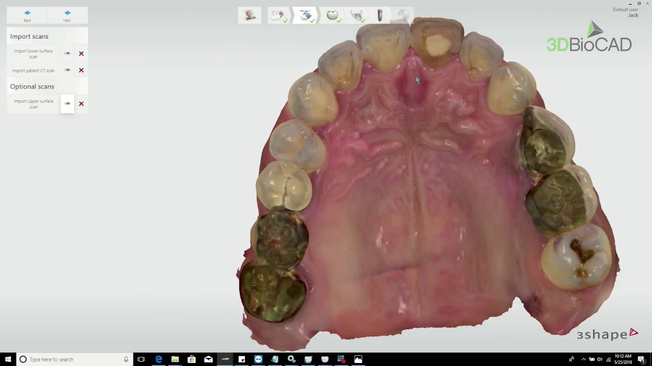 3DBioCAD - Implant Studio Surgical Guide FB Live