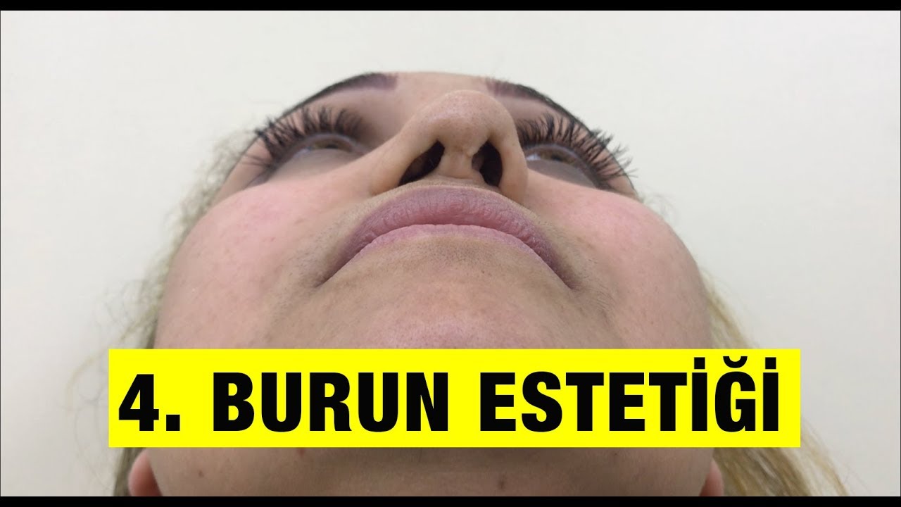 3 Kez Burun Estetiği Yaptırdım Son Olarak Doğru Doktoru Buldum !!