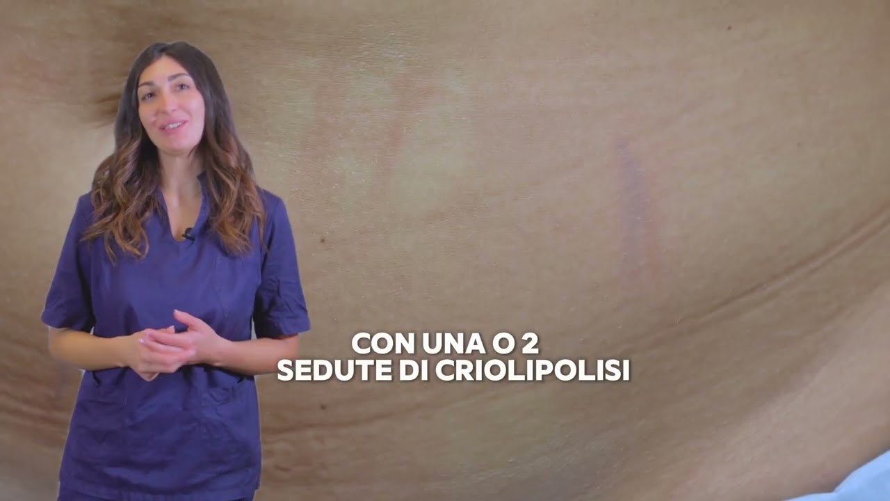 CRIOLIPOLISI WAITING ROOM