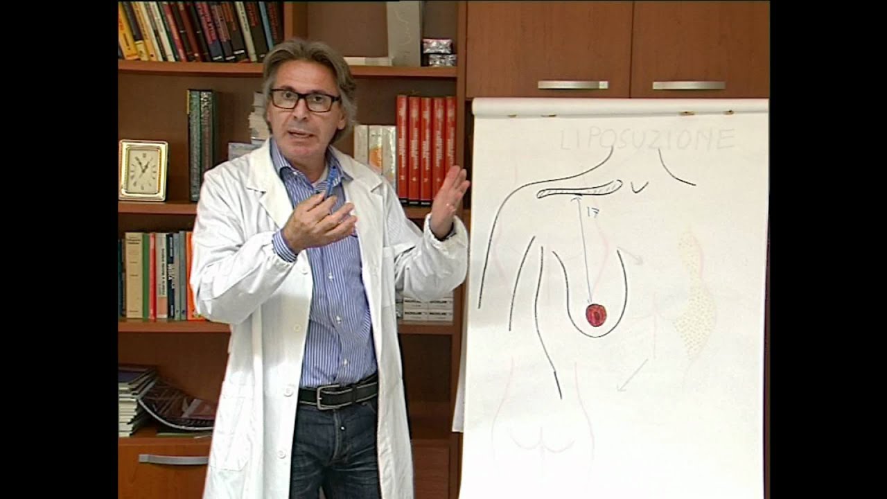 Mastoplastica additiva ep.3: intervento chirurgico di ingrandimento del seno