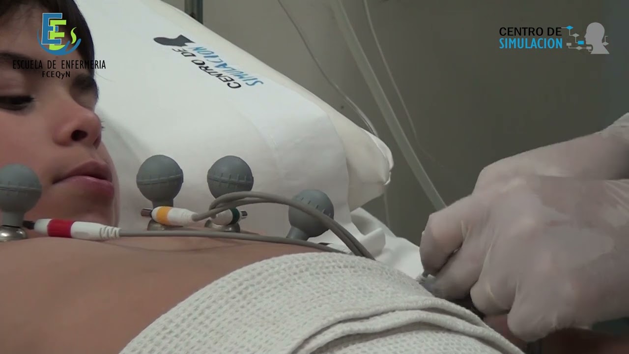 ELECTROCARDIOGRAMA