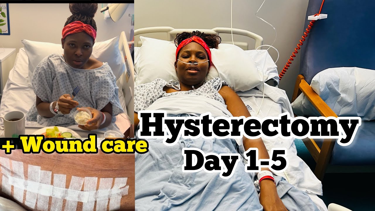 OPEN HYSTERECTOMY SURGERY (MY EXPERIENCE)