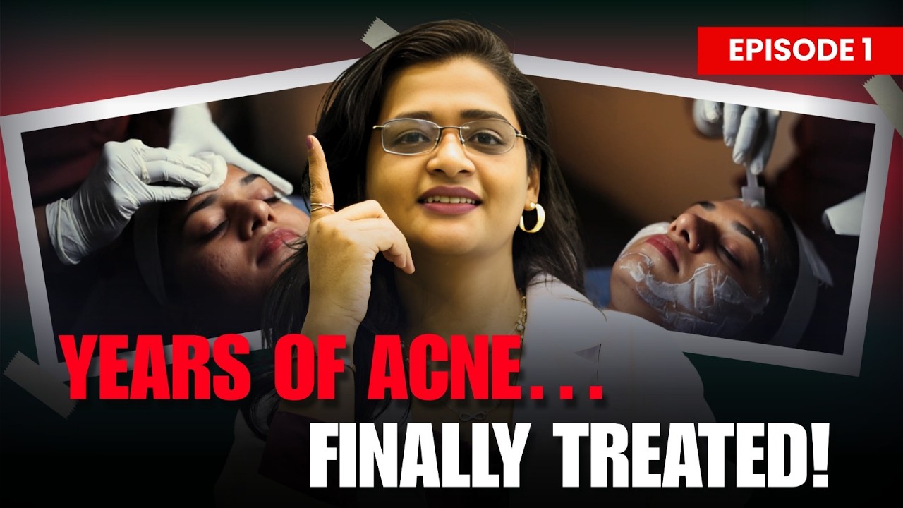 She Tried Everything For Acne&hellip; Until She Came To Our Clinic! | Clear Skin Clinic, Pune