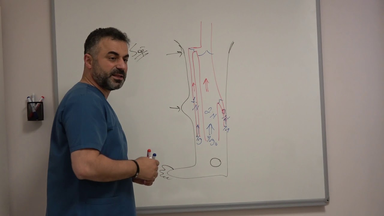 Vajinal Kasık Varisleri ile beraber Bacak Varisleri - Prof. Dr. Ahmet AKGUL