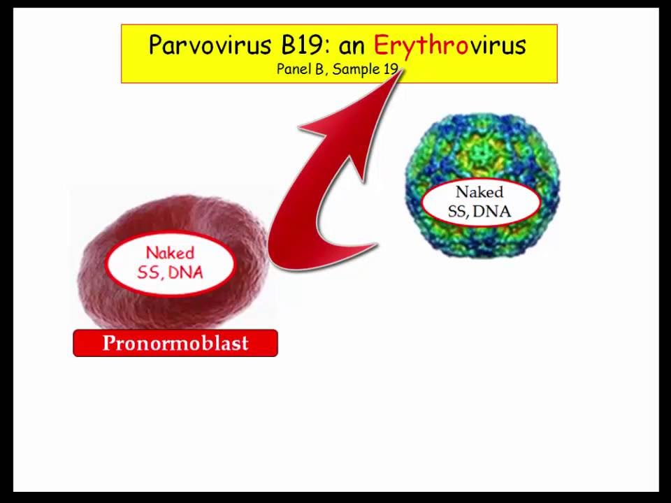 12DaysinMarch, Parvovirus B19 for USMLE Step One