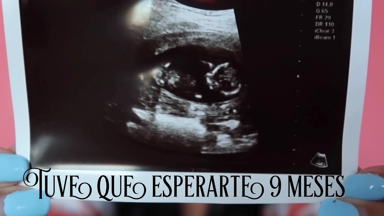 Así nos enteramos de mi embarazo! 💕 LOLA