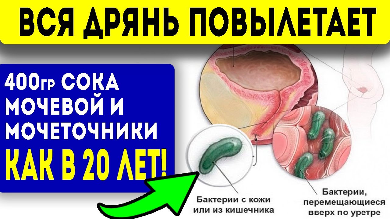 2 стак. ЭТОГО СОКА ВЫГОНИТ из мочевого пузыря, мочеточников и почек всю гадость! Народная медицина!