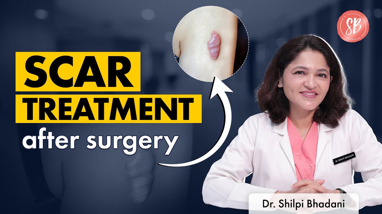 Heal scars after surgery | Scar Removal Laser | SB Aesthetics | Best Plastic Surgery Clinic in India