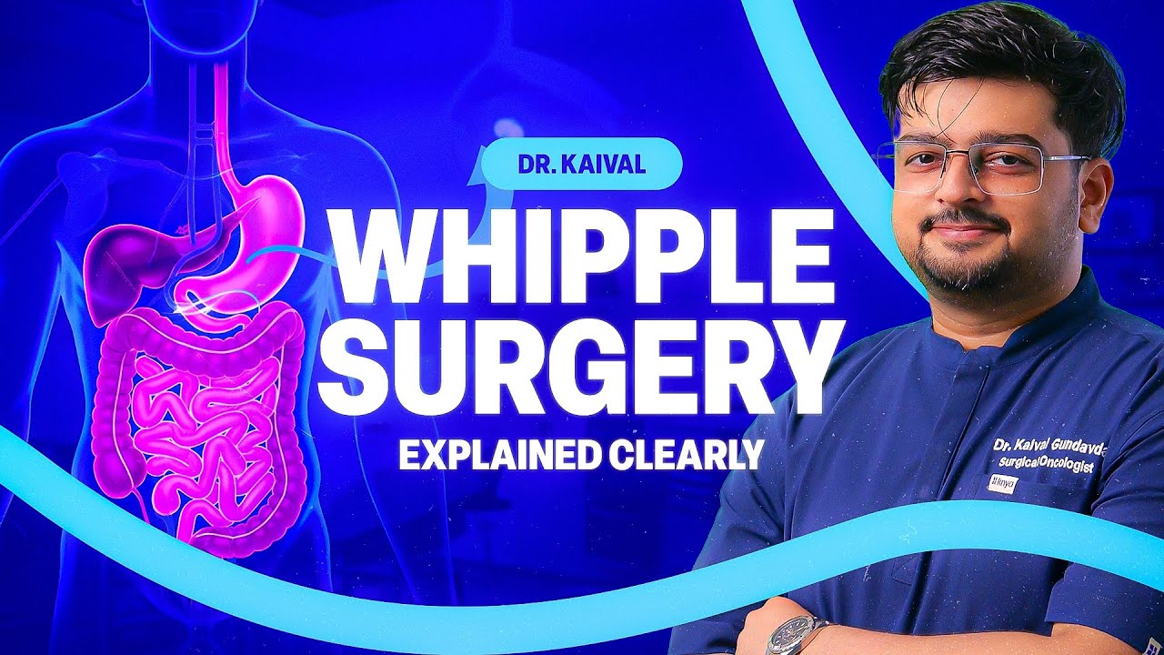 Whipple Procedure Explained Step by Step | Pancreatic Cancer Surgery