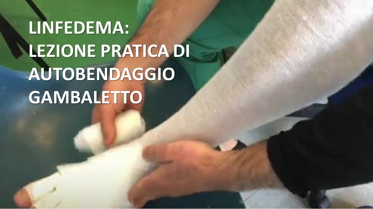 DR. STEFANO ARCIONI - LINFEDEMA: LEZIONE PRATICA DI AUTOBENDAGGIO GAMBALETTO