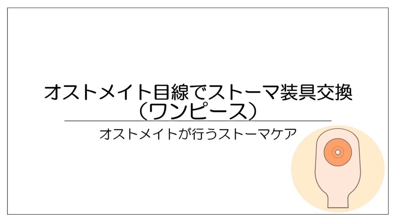 【ストーマケア】オストメイト目線でワンピース装具の交換する