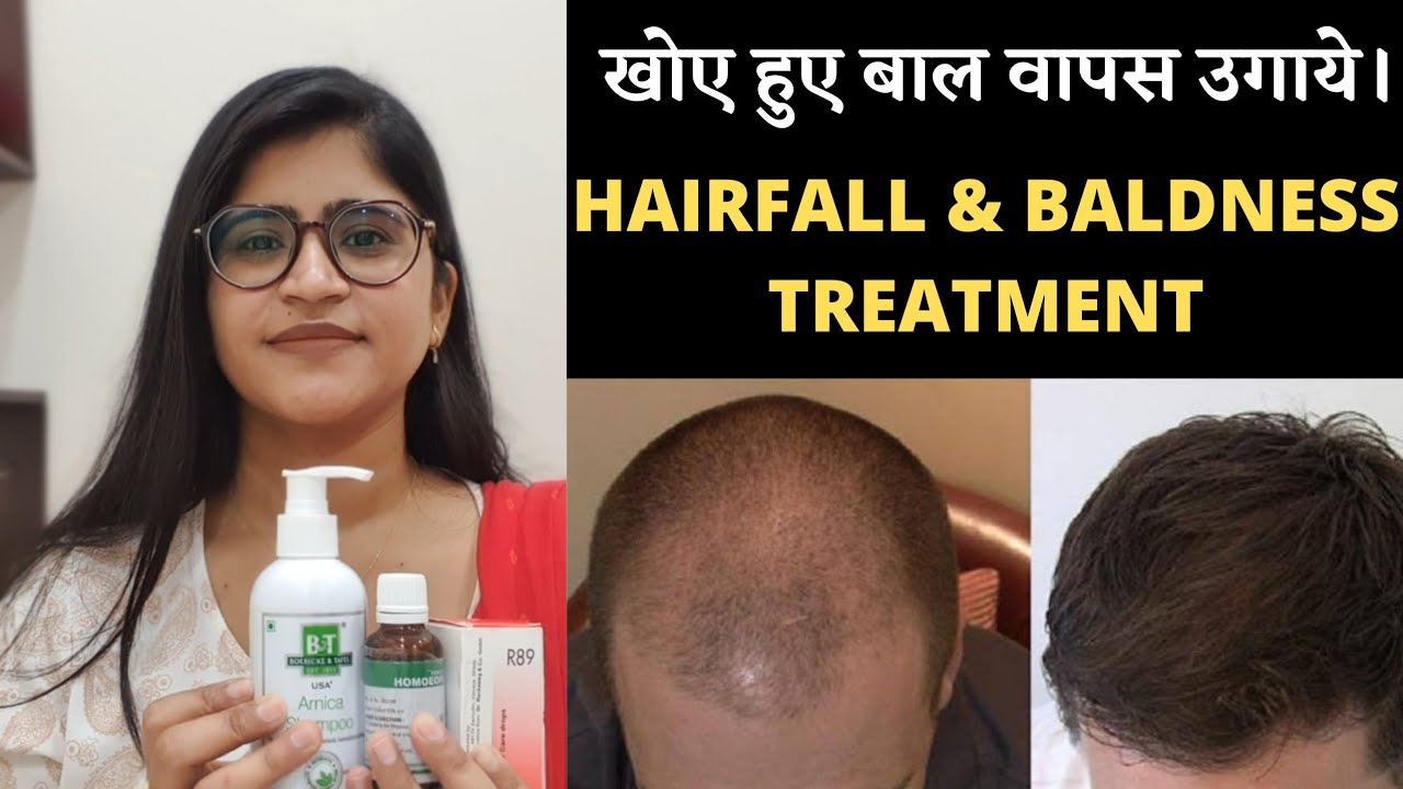 Hairfall And Baldness Treatment।।खोए हुए बाल वापस उगाये।।Hair regrowth medicines||