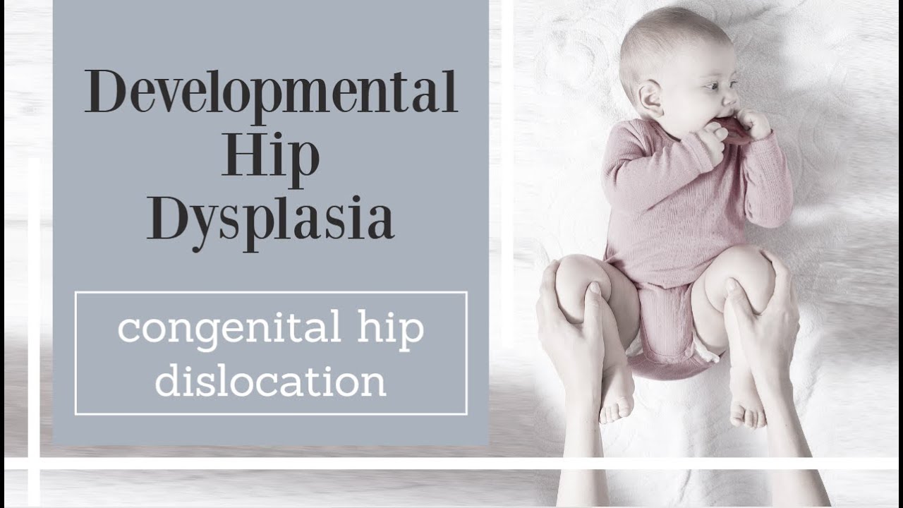 Developmental Hip Dysplasia - congenital hip dislocation