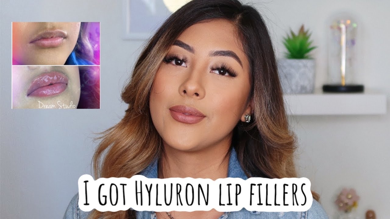 I GOT HYLURON LIP FILLERS (NO NEEDLES)